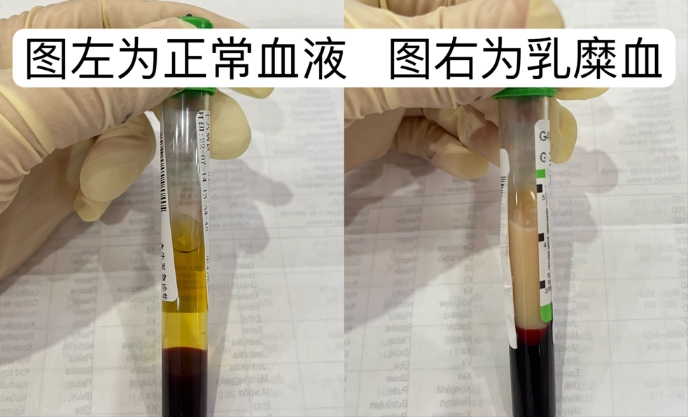 不仅口红有色号血液也有还不快来看看你的血液是不是健康色