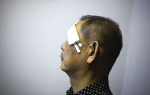 左侧眉骨受伤的沈大伯。