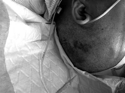 病床上的华师傅（图片由华师傅家人提供）