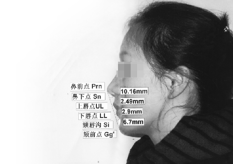 “一指禅”测美丑靠不靠谱？