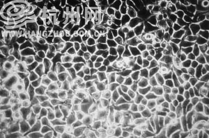 在显微镜下，正常人眼睛色素上皮细胞。