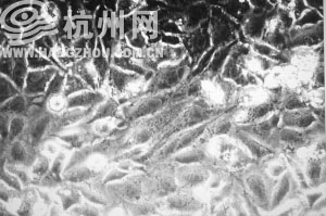 在蓝光下暴露24小时后，眼睛色素上皮细胞形态发生改变。