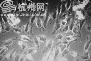 在蓝光暴露48小时后，色素上皮细胞数量明显减少，生长受抑制，死亡细胞明显增多。