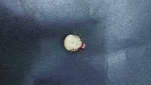 大姐腿上油光发亮的是什么?白色围棋子?硬蜱虫! 大姐腿上油光发亮的是什么?白色围棋子?硬蜱虫!