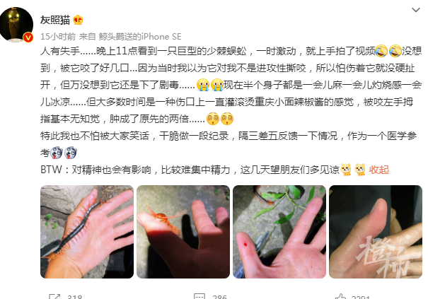 杭州百万粉丝科普博主 马拉松运动员昨晚遭被巨型蜈蚣咬伤 刚刚回应记者 